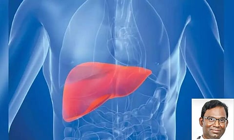 Maintaining healthy liver is crucial for overall well-being