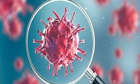 Representative image