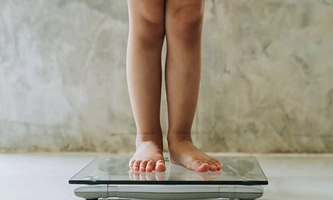 Representative image