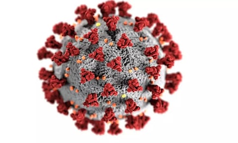 Representative image