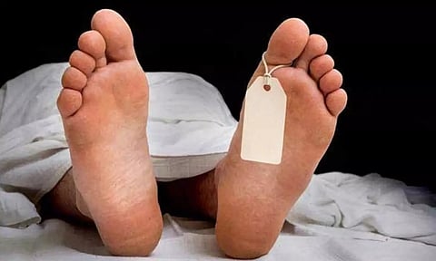 Representative image