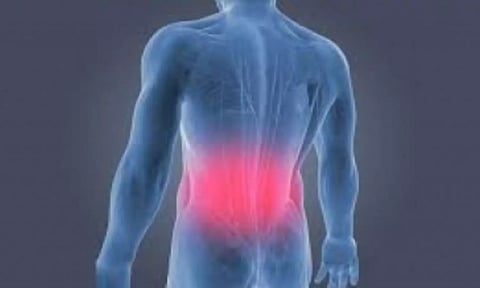 Representative image