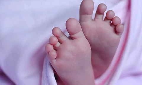 Representative image