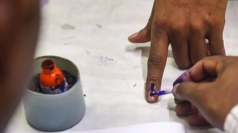 Representative Image