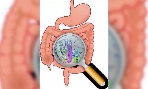 Representative image