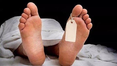 Representative Image