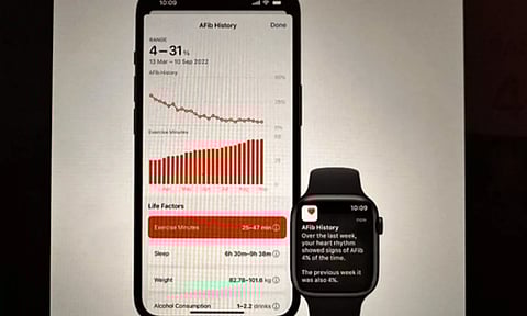 Representative image (PHOTO: IANS)