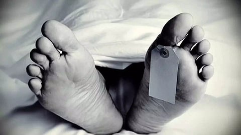 Representative Image