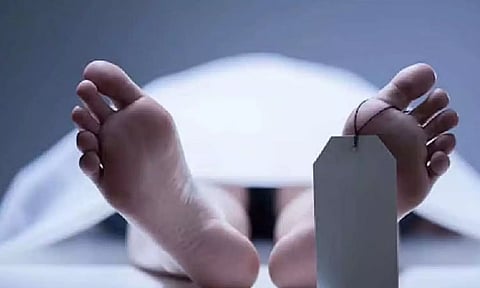 Representative Image