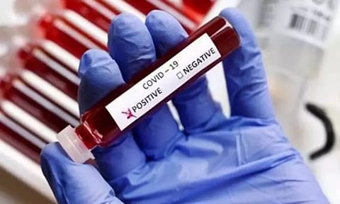 Representative Image