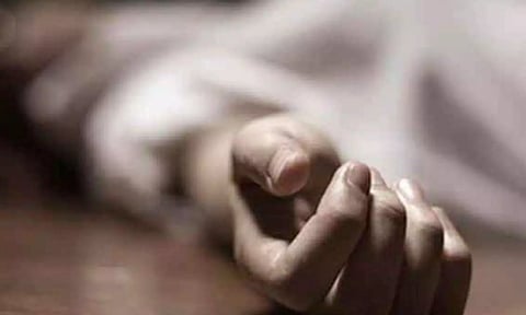 Representative Image