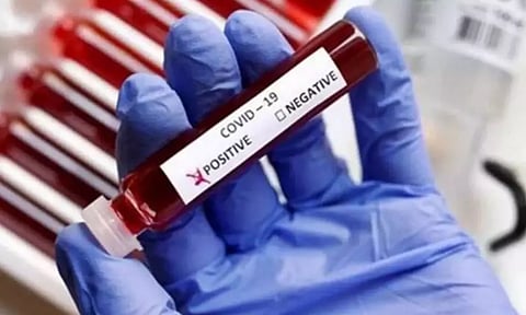 Representative image.