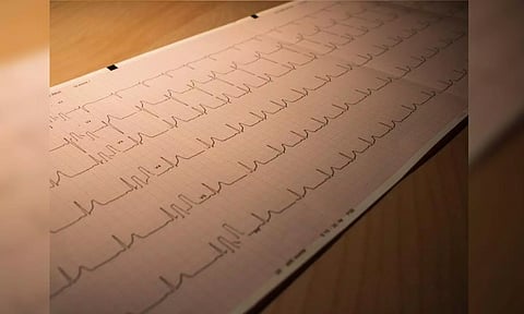 Representative image ( Photo : ANI)