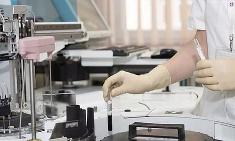 Representative Image