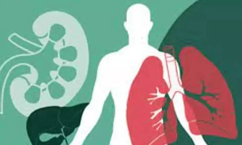 Representative image (File)