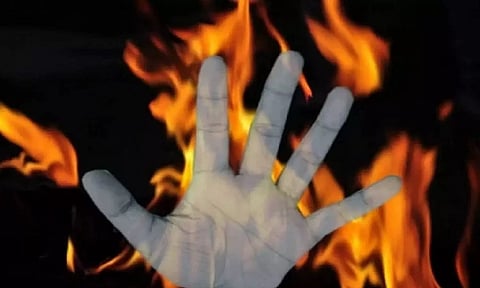 Representative image (File)