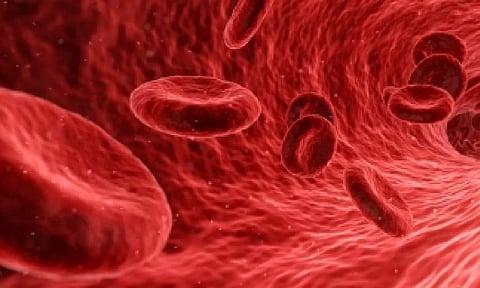 Representative image