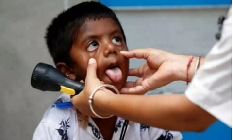 Representative image