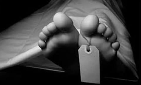 Representative Image