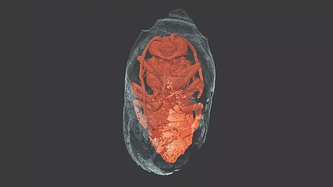 Representative Image