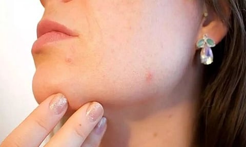 Representative Image (Photo:PTI)