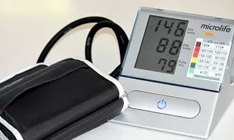 Representative image