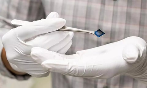 Representative image