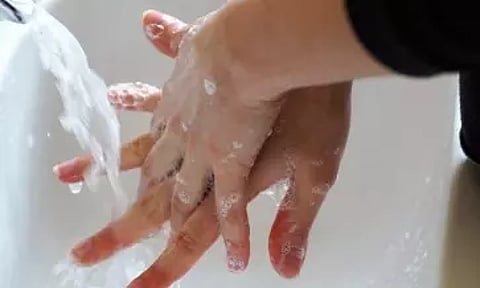 Representative image