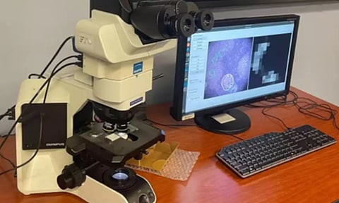 Representative image