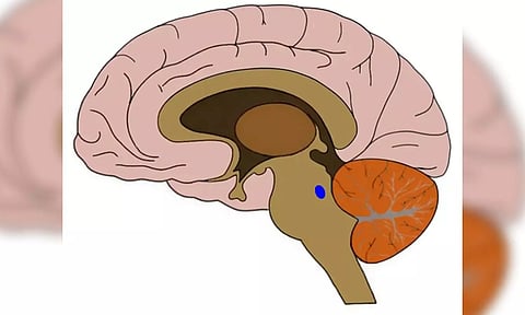 Representative image