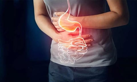 Representative image