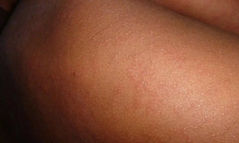 Representative Image (Image: IANS)