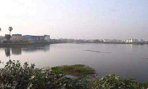 Representative image