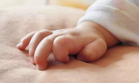 Representative image