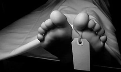 Representative Image