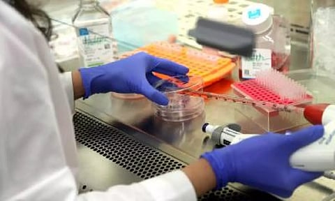 Representative image