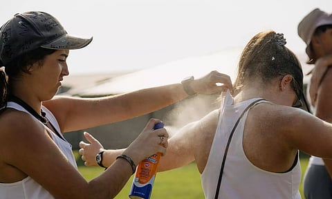 Representative Image