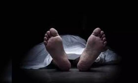 Representative Image