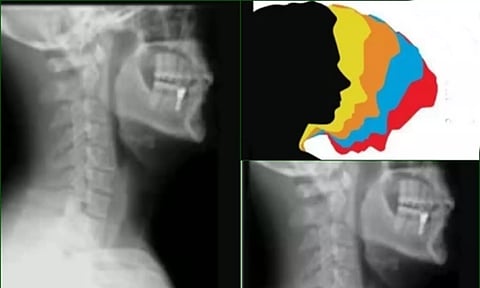 Representative image (Photo: IANS)