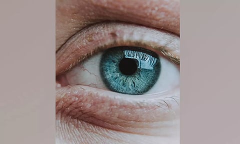 Representative Image (ANI)