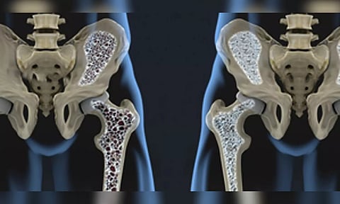 Representative image (Photo: IANS)