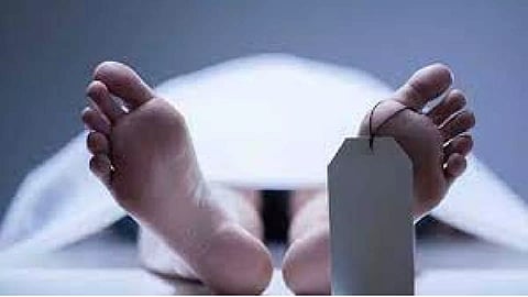 Representative Image