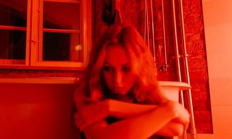 Representative image