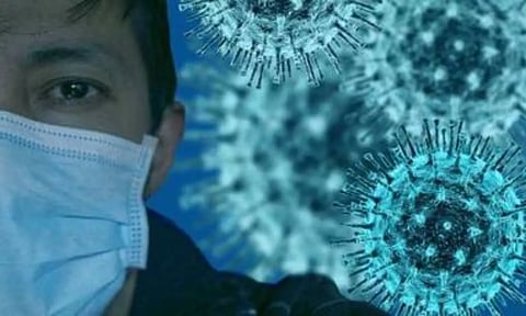 Representative image