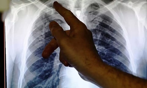 Representative image (Photo: Reuters)