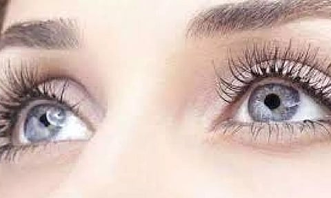 Representative Image