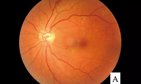 Representative image