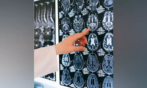 Representative Image: (Image: ANI)