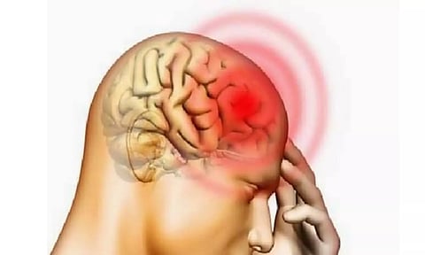 Representative image.