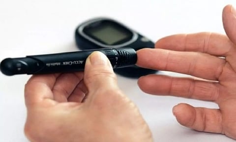 Representative image